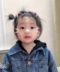 可怜!女儿3个月开始长湿疹 现在2周岁了 一直反反复复...