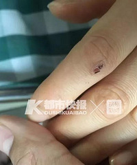 ������Ůʧ��������̼� ι�߱�ҧ������ͣ��