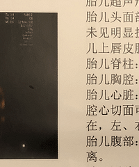 780元做的四维好清晰 看到宝宝内心没那么慌张了