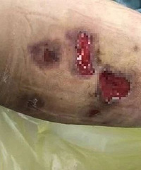 裡һŮ˫ȲҲ̶ãȥԺ