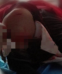 Զ���ǻ��������ﳵ��ײ ��Ѫֱ��