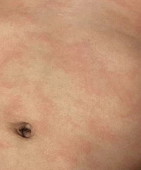 �����Ϻ�������� ��˵��ʪ��