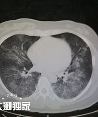 ̫���գ�����һ�����ڿ�������˺�����Ӳ�5���´�