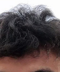 我还有变直的可能性吗?