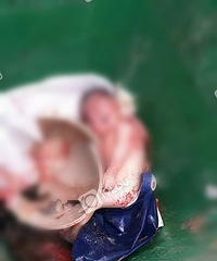 ȫ𾪣˽ͷĳͰһѪܵӤ˵Ѿ