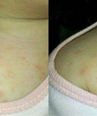 �޵��˸���ʪ�� һ�����Ͼ�ץ����ͣ��