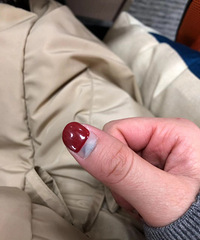 真背!网红女车主手指被车门夹出淤青!据说用冰淇淋敷……
