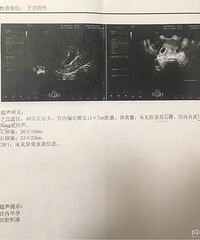 人生最黑暗的一天 肚子疼去产检被告知先兆流产 要卧床服药..