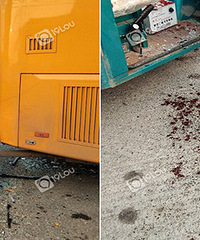 �������ֳ���У����ײ������Ѫ��һ�ء�