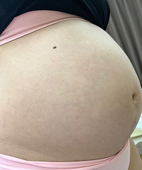 心拔凉拔凉的 孕5个半月重了12斤 肚子像六七个月大!
