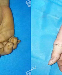 ���̣�����һŮ�ӱ��Ϲ�������ָ��