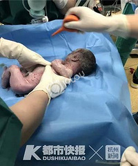 嘉兴孕妇早产发生危急情况!父亲打算放弃孩子前的一句话让人泪崩