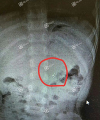 ��������3��Ůͯ����ˮ�������볦�ӣ�����Ϊ�������