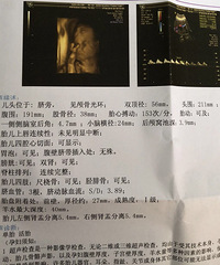 怀孕后每天吐七八次 一点没胃口 感觉人生到达了巅峰!