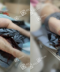 ����һ�����ﳵ���������£�Ѫ��ģ��