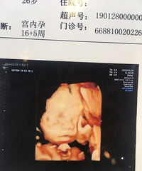 吓死!孕28周宝宝缺氧住院 医生说随时会早产!