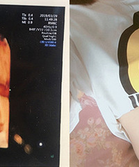 ��������28�ܱ���ȱ��סԺ ҽ��˵��ʱ�����