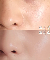 �������ֲ��Ƽ������ɹ�󼱾���ĺ����� ë�׶����С