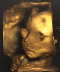 �þ��µı��� ��ȫ�����˰ְֵĸ߱���