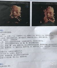 还没做好准备宝宝就好了 早期让人闻风丧胆的孕吐一次也没经历过