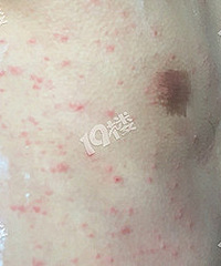 �ѵ�ҽ��������ĳ��԰һ���κ�ȫ������