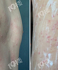 �ѵ�ҽ��������ĳ��԰һ���κ�ȫ������