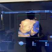 �����Ҫ��Ů��