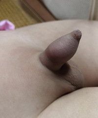 宝宝的小鸡鸡像被什么咬了