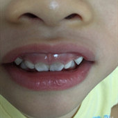 ���������ϱ����ô��