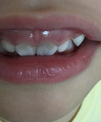 ��������ʯ���������� ˢ����ˢ������