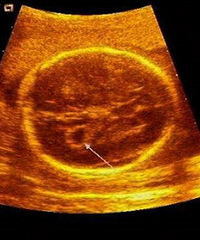 ���ģ���19�ܼ���̥���Ҳ��Բ������������