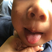 ������ͷһ����͹��