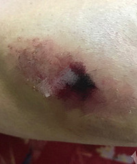 ���������豻����С��ײ�ˣ��⳥ȴ����