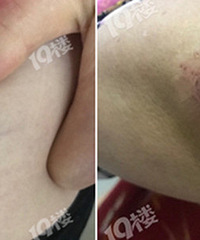 ���������豻����С��ײ�ˣ��⳥ȴ����