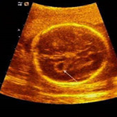 ̥���Ҳ��Բ�������