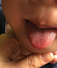 33��������ͷ��һ����͹����ʲôԭ��