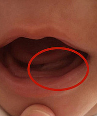 ������ͷ��͹��һ������ô��