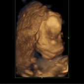 ��������������