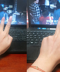 93�����GG ҽԺ���� �з� ��С�ɿɰ���