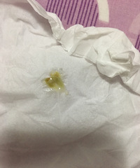 丁医生急