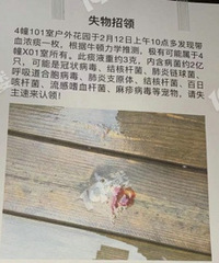 ʧ�����죺һ��Ѫ̵������������Ҽ��