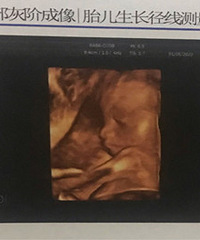 �ڴ���̥С�����Ľ��� ����̥̫����