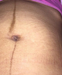 ���꺢��ͷʹ�� ������������ִ��������Ա�