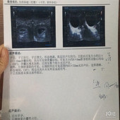 �����ڲ����������