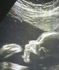 ����û�뵽 �����ڼ�ӭ���˶�̥