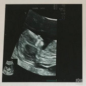 ��������е㲣����