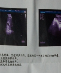 ���к��Ϲ��󲿷�ʱ�䲻�� Խ��Խ�ѹ�