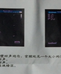 �����ѿ���������ά��Ƭ ����Ȼ˵����