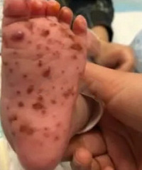 Ӥ���͸�����ܽӴ� ���϶ദ��������