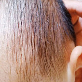 ��������˯����ͷ��